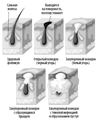 Взламывая анатомию