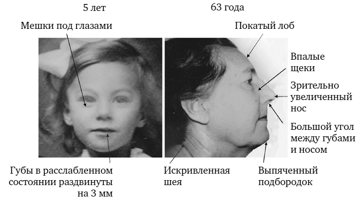 Укус эволюции. Откуда у современного человека неправильный прикус, кривые зубы и другие деформации челюсти Укус эволюции. Откуда у современного человека неправильный прикус, кривые зубы и другие деформации челюсти
