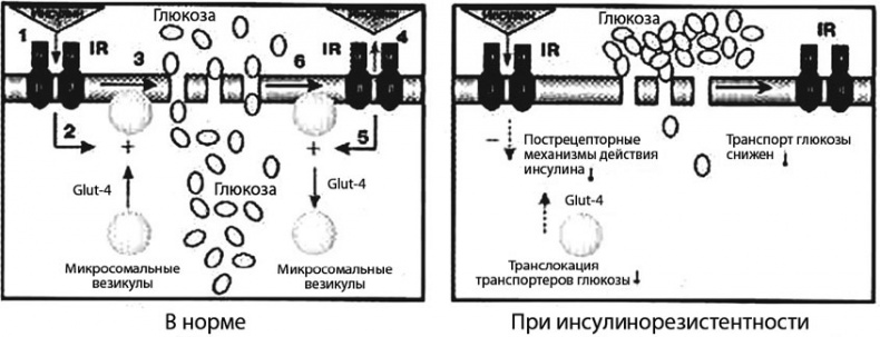 Сахарный диабет Сахарный диабет