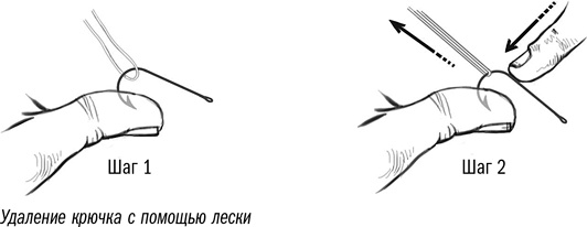 Первая помощь своими руками. Если скорая не спешит Первая помощь своими руками. Если скорая не спешит