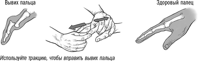 Первая помощь своими руками. Если скорая не спешит Первая помощь своими руками. Если скорая не спешит