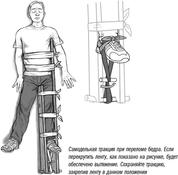 Первая помощь своими руками. Если скорая не спешит Первая помощь своими руками. Если скорая не спешит