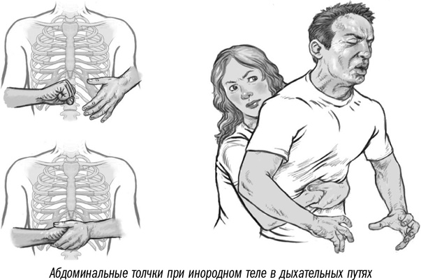 Первая помощь своими руками. Если скорая не спешит Первая помощь своими руками. Если скорая не спешит