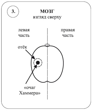 Исцеление воспоминанием Исцеление воспоминанием