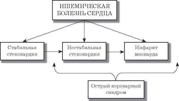Стенокардия Стенокардия