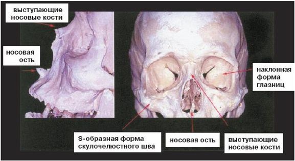 Эректус бродит между нами. Покорение белой расы Эректус бродит между нами. Покорение белой расы