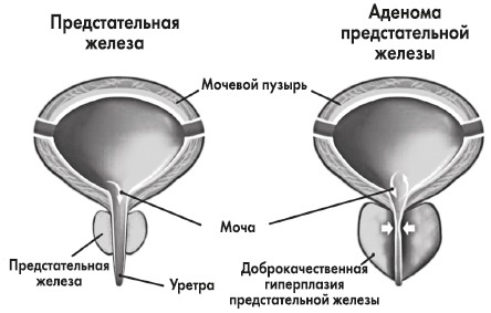 Вся правда о гормонах и не только Вся правда о гормонах и не только